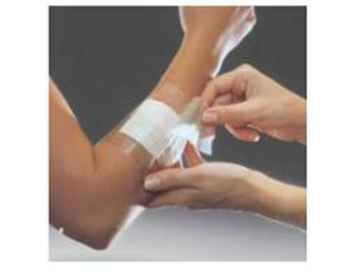 OPSITE FLEXIFIX 10X1000 1MED